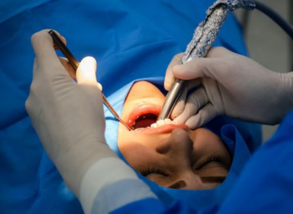 ایرانی ها ۳۰۰میلیون دندان پوسیده دارند
