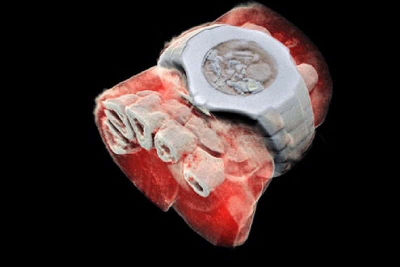 نخستین تصاویر رنگی سه بعدی از بدن انسان