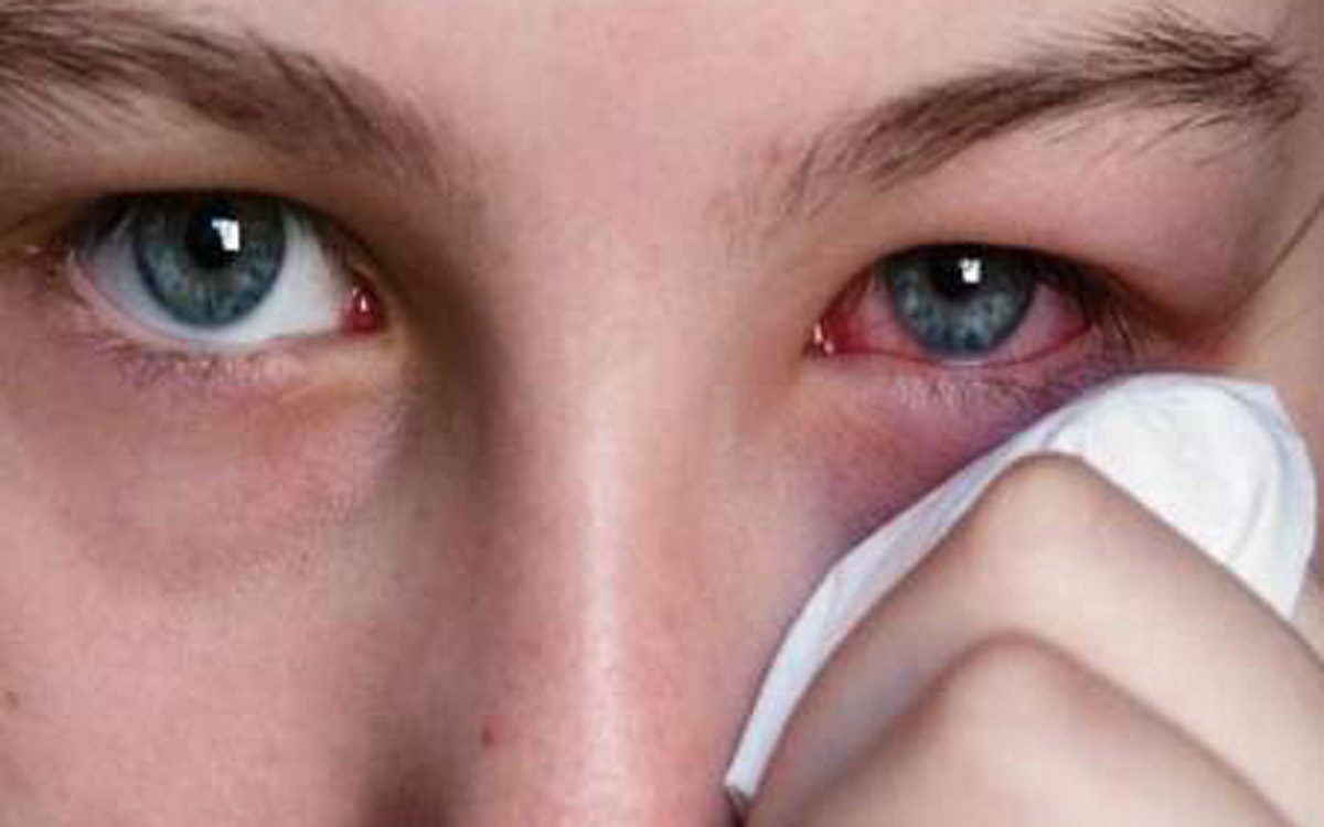 تشخیص آسیب دیدگی چشم با استفاده از اشک