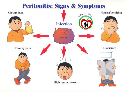 بیماری پریتونیت چیست ؟