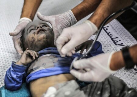 معاینه کودک مجروح فلسطینی در نوار غزه