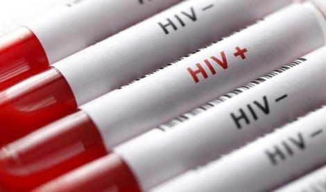 آخرین وضعیت HIV در کشور