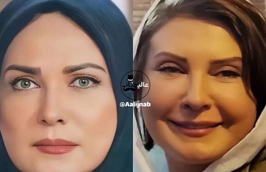 چهره لعیا زنگنه بعد از جراحی زیبایی/تصاویر