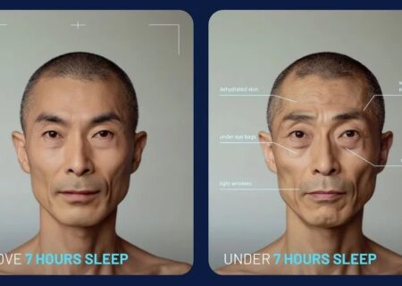 اگر ۷ ساعت خواب شبانه نداشته باشید چه اتفاقی برای صورت شما می افتد؟