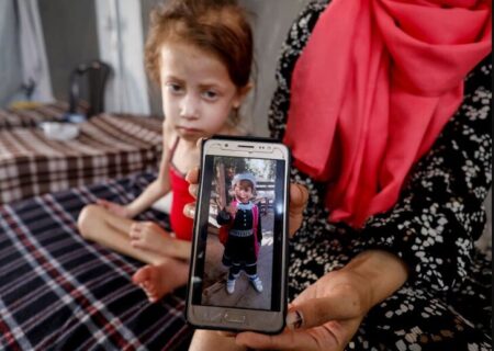 کودکان دچار سوء تغذیه در نوار غزه